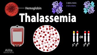 Thalassemia Alpha amp BetaThalassemias Genetics Pathophysiology Diagnosis amp Treatment Animation [upl. by Ecneralc]