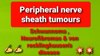 Peripheral nerve sheath tumours [upl. by Bello]