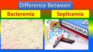 Difference between Bacteremia and Septicemia [upl. by Dasya665]