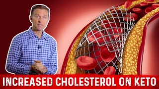 Keto And Cholesterol Why LDL Can Increase on Low Carb Diet – Dr Berg [upl. by Martz]