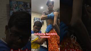 Chiropractic treatment for Ankylosing Spondylitis chiropractor [upl. by Winnah282]