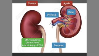 Insuficiencia renal crónica [upl. by Jack]