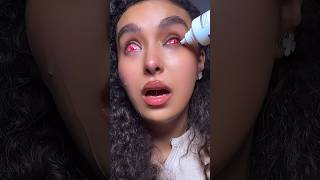 Part 2 😱 trying to remove sclera lenses 🧟‍♀️ nouhailaait [upl. by Thomasina668]