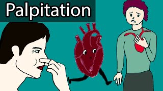 Heart Palpitations  Causes When to worry about heart palpitations [upl. by Moshe7]