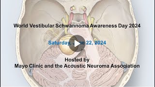 Vestibular schwannoma Molecularlyinformed therapies [upl. by Gare]