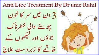 Anti lice Treatment By Dr Umme Raheel  To Get ride off from Head lice just in 3 Days  100 works [upl. by Alleul706]