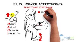 Emergency Medicine  Hyperthermia By Anjali Hulbanni MD and Mudassir Khan MD [upl. by Elfrieda]