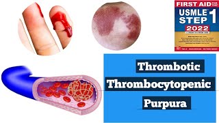 Thrombotic thrombocytopenic purpura TTPHUS Hematology lacturesDoctors goal [upl. by Avie]