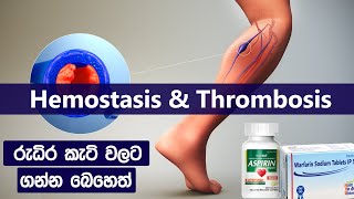 රුධිර කැටි නිසා ඇතිවන හානිය 😨 hemostasis and thrombosis in sinhala  treatment for blood clots [upl. by Sajet366]