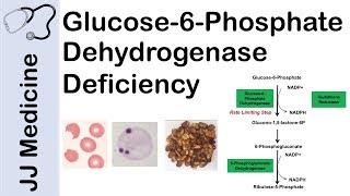 Glucose6Phosphate Dehydrogenase Deficiency  Symptoms Pathophysiology Diagnosis and Treatment [upl. by Aikemat163]