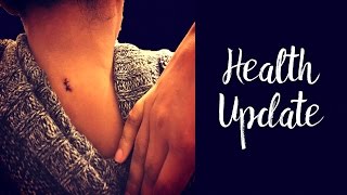 A Tumor On My Neck  Neurofibroma Health Update [upl. by Chin]