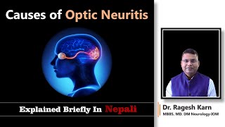 Optic Neuritis Key Factors and Causes Explained  By Dr Ragesh Karn opticnerve knowledge [upl. by Anaitat248]