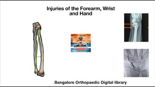 MBBS Forearm Wrist and Hand injuries [upl. by Doggett77]