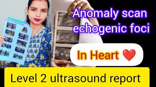 Anamoly Scan में Heart में Echogenic foci क्यों दिखाई देता है My second pregnancy Report [upl. by Ahsinna]