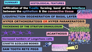 LICHEN PLANUS HISTOPATHOLOGY [upl. by Toland]