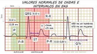 ELECTROCARDIOGRAMA NORMAL GUÍA DEFINITIVA [upl. by Queridas]