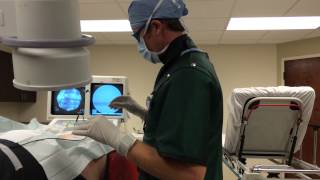 Dr McRoberts performs a Facet Joint Nerve Ablation in Real Time With a Real Patient [upl. by Miguelita773]