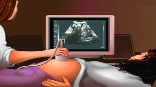 How Ultrasound Works Animation  Ultrasound Scan During Pregnancy Video  USG Medical Imaging [upl. by Glynnis]