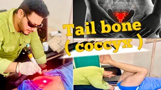 Tail Bone Adjustment by Chiropractor  Tailbone Pain Relief in sec  Coccydynia  Dr Aman Rasotra [upl. by Nananne851]