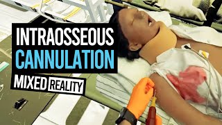 INTRAOSSEOUS IO CANNULATION WHILE IMMERSED IN MIXED REALITY ON THE VARJO XR3 [upl. by Ferdinande755]