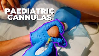 Get your paediatric cannula in first time  IV cannulation top tips [upl. by Lasser]