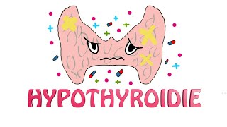 LHypothyroïdie diagnostic cliniquebiologiqueétiologies et traitement [upl. by Eciuqram]