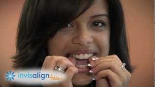 Invisalign and Invisalign Teen  How it Works and What to Expect [upl. by Gnahc34]