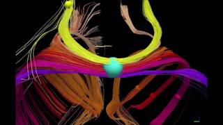 A panmammalian map of interhemispheric brain connections predates the evolution of the corpus [upl. by Loziram]