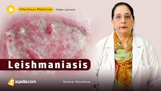 Leishmaniasis  Infectious Clinical Medicine Video  VLearning  sqadiacom [upl. by Tlaw964]