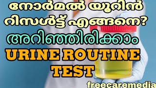 Urine test malayalam  Urine routine testmedicallaboratorytechnician urinetest [upl. by Kass703]