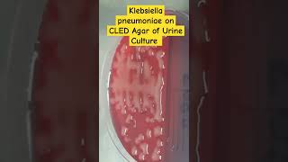 Klebsiella pneumoniae colony morphology on CLED of Urine Culture [upl. by Alarick]