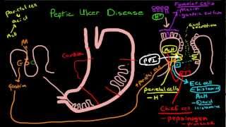 Peptic Ulcer Disease Pathophysiology [upl. by Lulu]