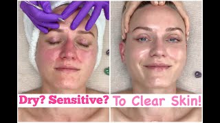 Brightening amp Clarifying Facial for Combo Sensitive Skin Extractions amp Meditation Massage  ASMR [upl. by Jorgenson]