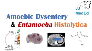 Amebiasis Amoebic Dysentery  Entamoeba histolytica Pathogenesis Signs amp Symptoms Treatment [upl. by Soisatsana]