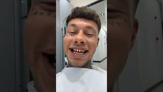 These Dentists DESTROYED His Teeth [upl. by Tiff]