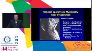 Surgery is Appropriate for Cervical Spondylotic Myelopathy [upl. by Chow]