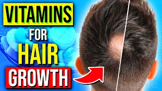 7 BEST Vitamins amp Nutrients For Instant HAIR GROWTH [upl. by Niltiak]