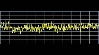 Scar Tissue  Rife Frequencies [upl. by Lliw]