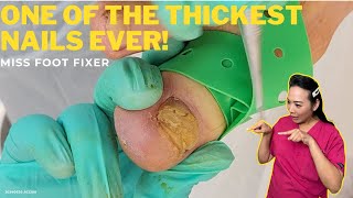 Exploring the Depths of the Thickest Nail Ever  Miss Foot Fixer [upl. by Munson]