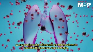 ¿Cómo se da la neumonía en los pulmones  ExclusivoMSP [upl. by Magda]