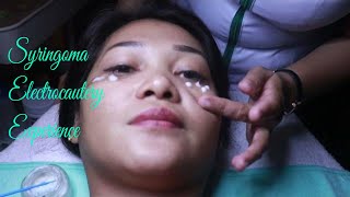 Syringoma Removal using Electrocautery Procedure at Nagasthetics in Naga City  Camarines Sur [upl. by Semela]