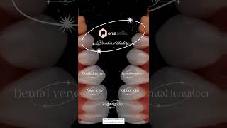 Veneer teeth lumineer teethdentistry ahmedkhodary orcasmile TeethWhitening teethcare [upl. by Acie360]