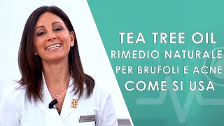 Tea Tree Oil Rimedio naturale per Brufoli e Acne Come si usa e errori da non fare [upl. by Halyak187]