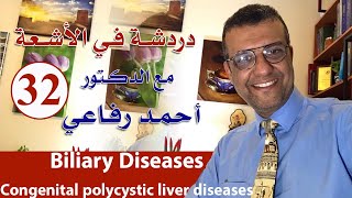 دردشة في الاشعة الحلقة 32  biliary system diseases 1 [upl. by Aisauqal460]