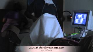 IVF Embryo Transfer [upl. by Lenna]