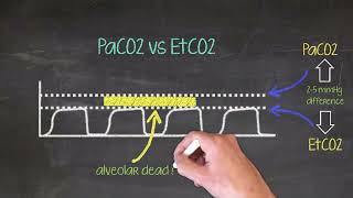 Capnography Other Considerations [upl. by Anaihs675]