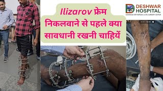 Ilizarov frame निकलवाते समय की सावधानियां Ilizarov stress test Ilizarov [upl. by Sregor467]