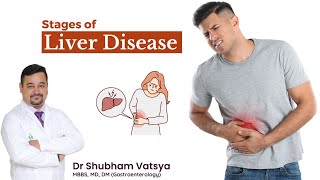 Stages of Liver Disease  Dr Shubham Vatsya liver liverdisease liverproblems stages stomach [upl. by Eeluj]