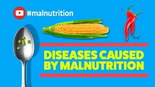 Diseases Caused by Malnutrition  SCURVY RICKETS BERIBERI PELLAGRA [upl. by Alyse257]