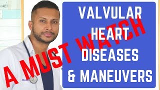 Heart Valve Murmurs amp ManeuversThe Best Explanation ever USMLE STEPs 1 2 amp 3 [upl. by Gensler657]